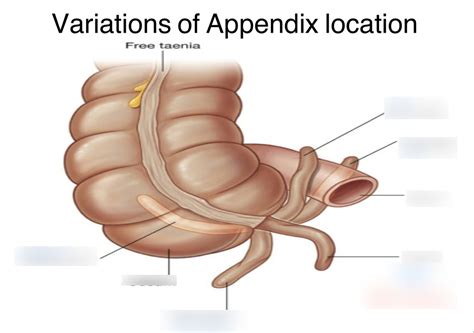 Image result for Appendix Labeled