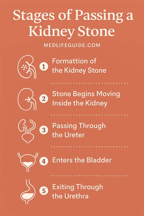 4 Stages of Passing a Kidney Stone: What to Expect