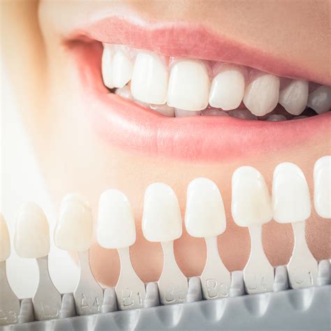Cosmetic Teeth Whitening - Safaa Aesthetic Academy
