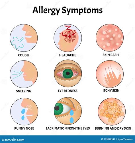 Symptoms Of Allergies Skin Rash, Allergic Skin Itching, Tearing From ...