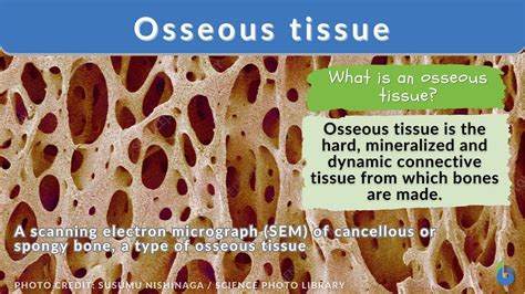 Osseous Abnormality