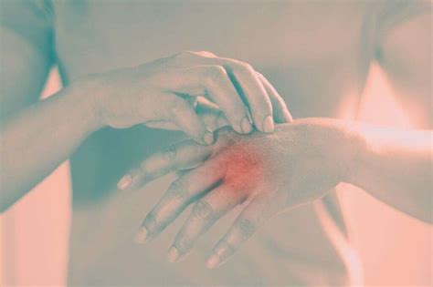 Image result for Diffuse Systemic Scleroderma