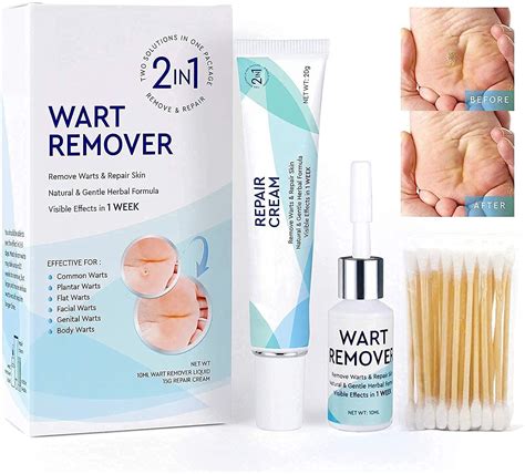 Buy Wart Remover for Common Warts, Plantar Warts, Flat Warts, Genital ...