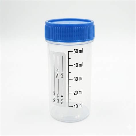 30ml Non-Sterile Urine Sample Container - Affordable Price for Bulk Supply