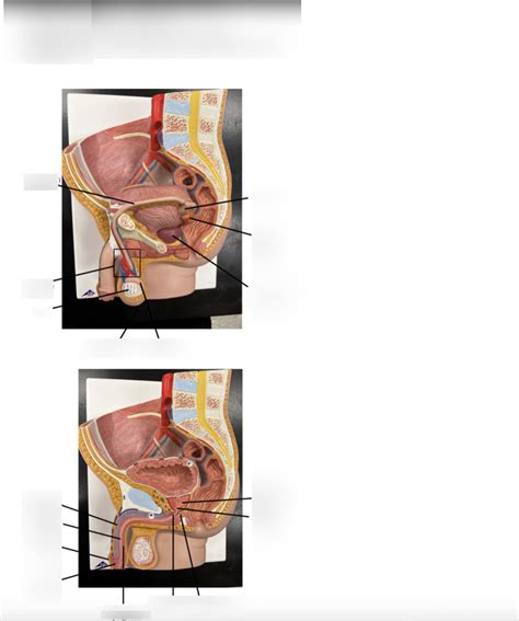 Image result for Male Reproductive Lab Model