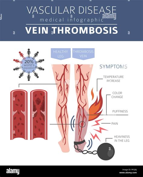 Vascular diseases. Vein thrombosis symptoms, treatment icon set. Medical infographic design ...