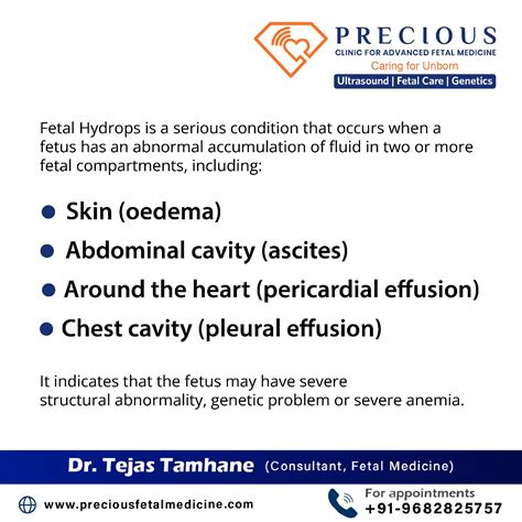 Fetal Hydrops: Diagnosis & Treatment - Dr Tejas Tamhane in Pune