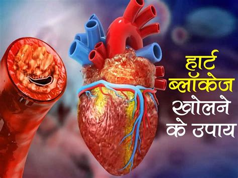 Heart Blockage : हार्ट ब्लॉकेज खोलने के लिए फॉलो करें ये आसान से टिप्स ...