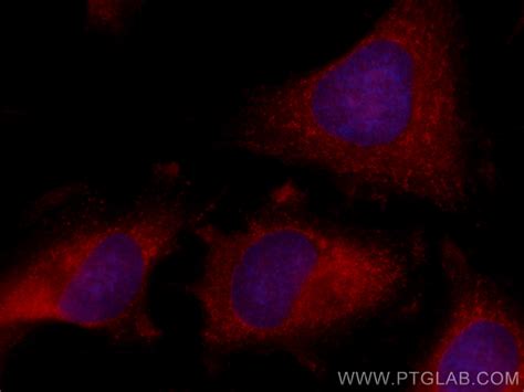 CBS antibody (CL594-14787) | Proteintech