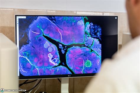 NanoString Spatial Transcriptomics 的图像结果