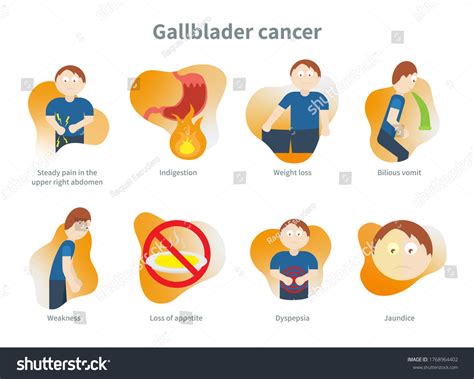 Gallbladder Cancer: Symptoms, Causes, Treatment – KXAEML