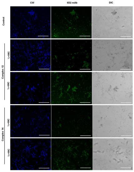 Silver(I) 1,10-Phenanthroline Complexes Are Active against Fonsecaea ...