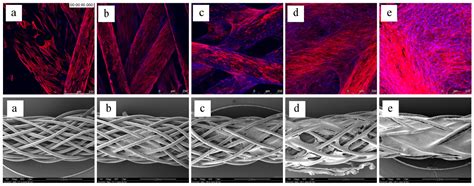 Towards a Tissue-Engineered Ligament: Design and Preliminary Evaluation ...