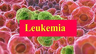leukemia 的图像结果