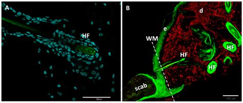 Foxn1 in Skin Development, Homeostasis and Wound Healing
