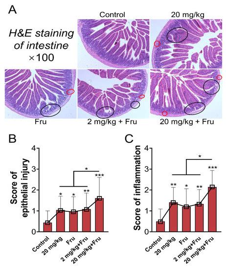 Foodborne TiO2 Nanoparticles Induced More Severe Hepatotoxicity in ...