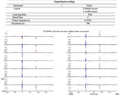 Image result for EEG Signal Processing Using Deep Learning