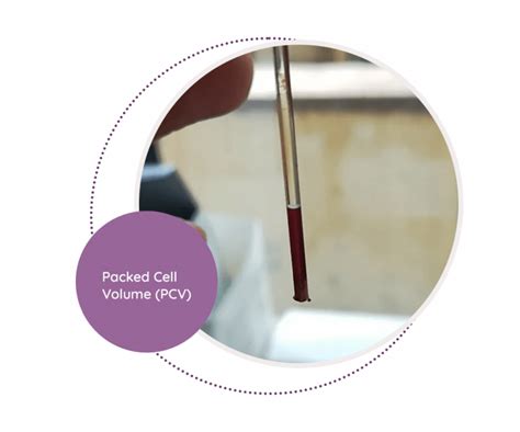 Image result for Complex String Layout