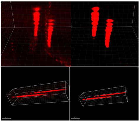 Distortion Correction and Denoising of Light Sheet Fluorescence Images