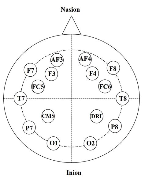 Tonic Cold Pain Detection Using Choi–Williams Time-Frequency ...