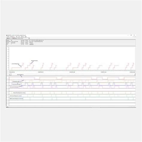 Image result for Stop Signal Reaction Time