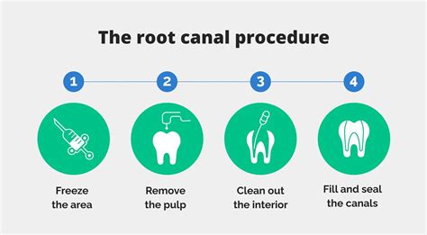 Does a Root Canal Hurt? What You Should Know