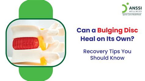 Can a Bulging Disc Heal Naturally? | Non-Surgical Spine Care