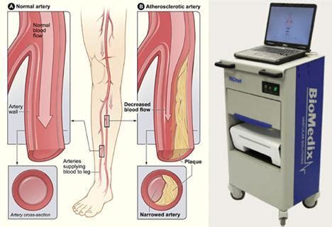 Image result for Blood Circulation Testing