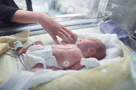 Neonatal Care – life-sustaining developmental care for neonates