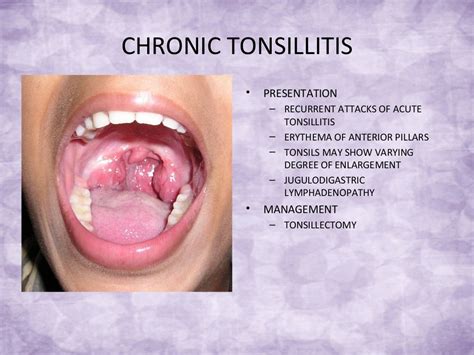 Rezultat imagine pentru ENT Problems