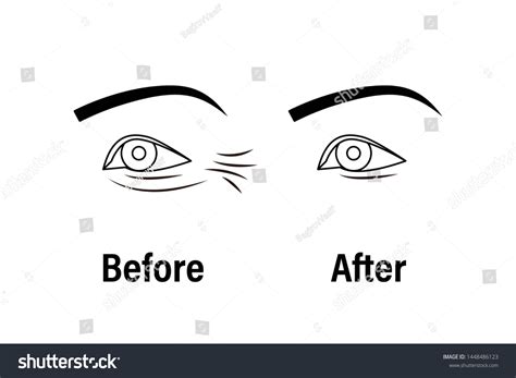 293 Crows feet eyes Stock Illustrations, Images & Vectors | Shutterstock