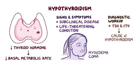 Early Menopause Hypothyroidism at Hugo Jenyns blog
