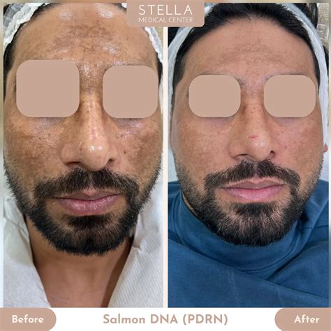 Stella Medical Center (@stella_medical_center) • Instagram photos and videos