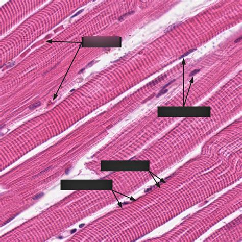 Image result for Skeletal Muscle Tissue Under Microscope