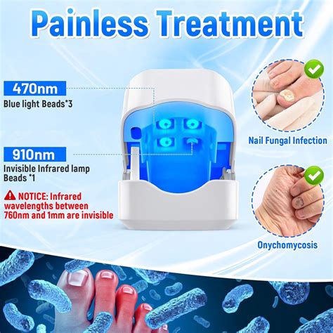 Anti Fungal Laser Device - Fast-Acting Nail Fungus Treatment | Home Treatment for Toenail ...