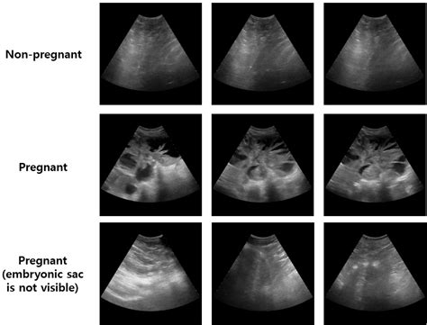 JAST (Journal of Animal Science and Technology)