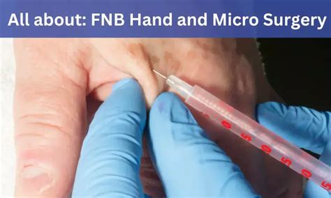 FNB Hand and Micro Surgery: Admissions, Medical Colleges, fees ...