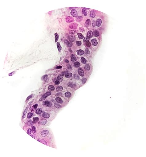Transitional Epithelium Urinary Bladder