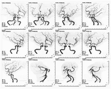 MRA/MRV – Spring Hill MRI and Imaging