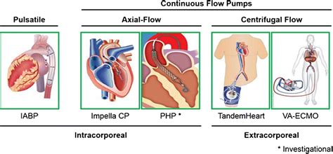 Randomized Trials Of Percutaneous Microaxial Flow Pump, 59% OFF