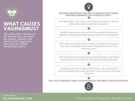 How Common Is Vaginismus