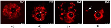 Chromatin Configuration in Diplotene Mouse and Human Oocytes during the ...