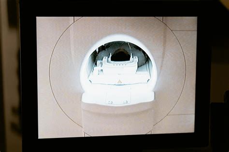 MRI vs. X-Ray: Understanding Your Imaging Options in India | Diseases ...