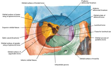 Orbital view of Skull - Netter | Anatomy, Dental anatomy, Oral pathology