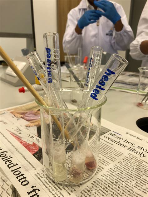 Image result for Liver Enzyme Lab Test