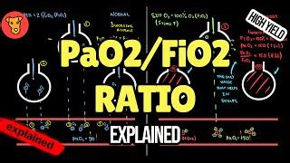 Image result for PaO2 FiO2 Ratio