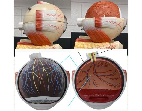 Lateral View of Eye Quiz