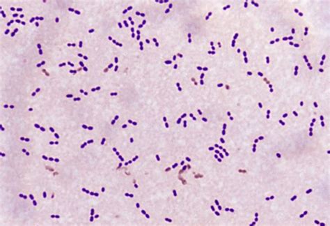 Image:Gram Stain (Streptococcus pneumoniae)-Merck Manual Professional ...