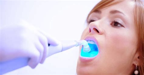 Do Dental Fillings Hurt? 4 Ways How To Ease The Pain At Home