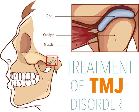 Jaw Pain | TMJ | Revolutionary Chiropractic Care for TMJ | Yorba Linda